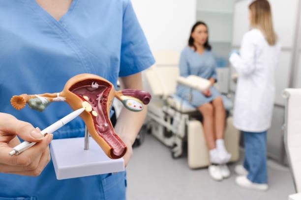Orientación sobre miomas uterinos